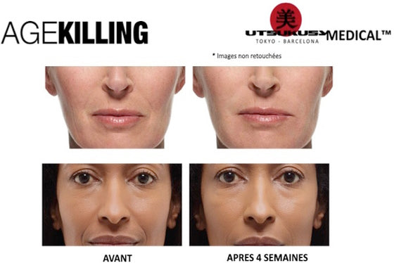 Soin anti-âge du visage et anti rides